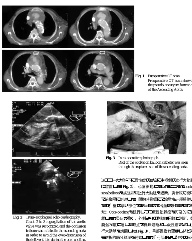 Fig. 1 Preoperative CT scan.