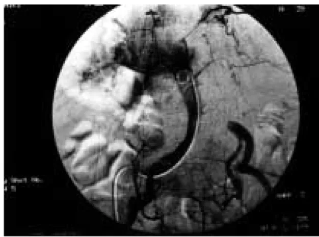 Fig. 3 Intraoperative photograph （Case 2）