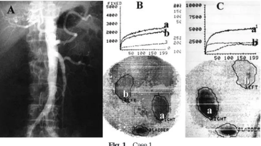 Fig. 2 Case 2 