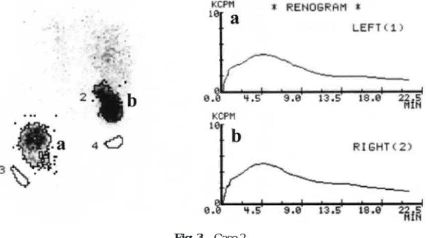 Fig. 4 Case 3