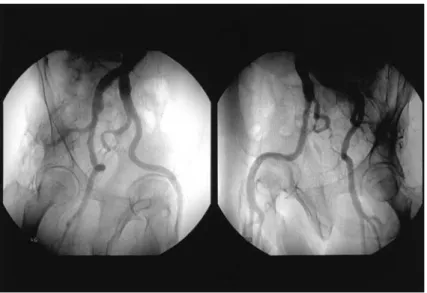 Fig. 3 DSA of postoperative nine months