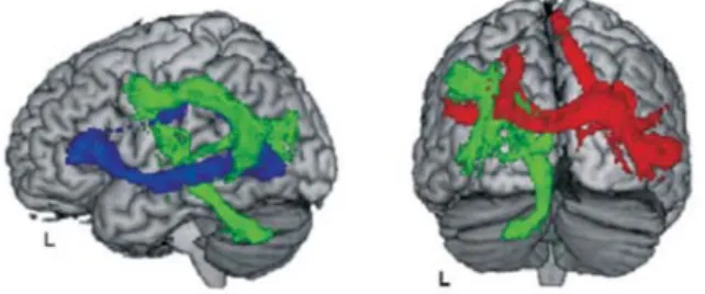Figure 5. Different processes of reading in hearers and signersFigure 4. Brain imaging of Japanese language processing
