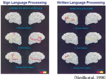 Figure 6. Brain imaging of bilingual processing