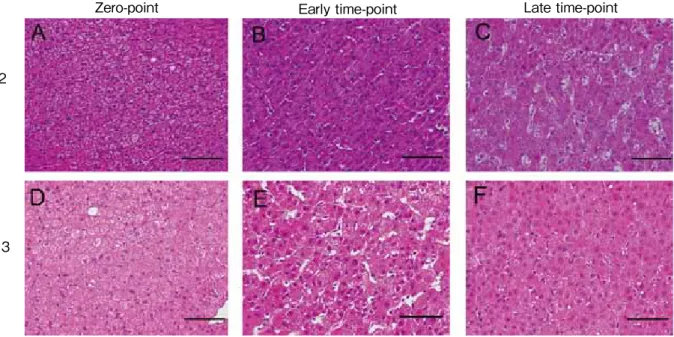 Fig. 2. H&amp;E staining of the liver in the process of regeneration.  (A) Zero point, (B) early  time point, and (C) late time point of case 2