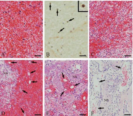 Fig. 2   Histological analysis of extraction sockets during healing. (A) Erythrocytes, leukocytes, and fibrin in the blood  coagulum immediately, 12 h, and 1 day after tooth extraction