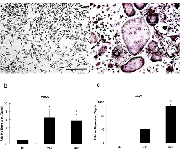 Figure 1    Differentiation of osteoclasts from murine bone marrow macrophages. 