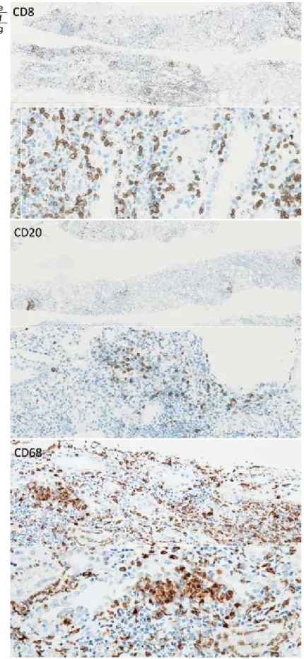 Fig. 1.　  Light microscopic findings in renal biopsy