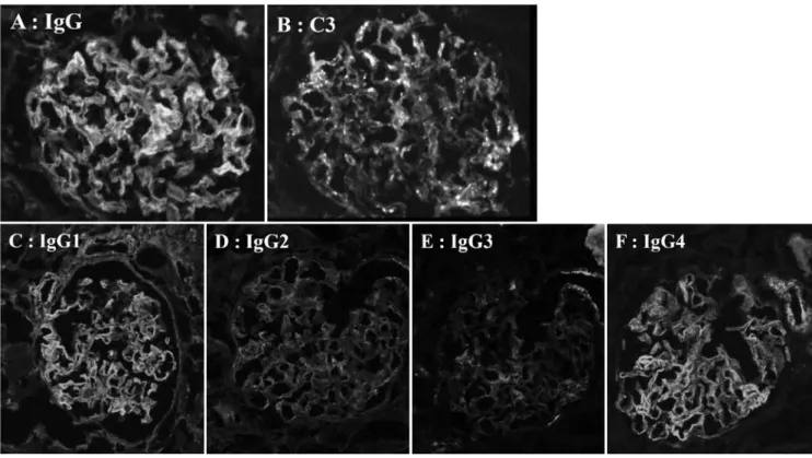 Fig. 2. 　 Immunofluorescent microscopy  （ IF ）