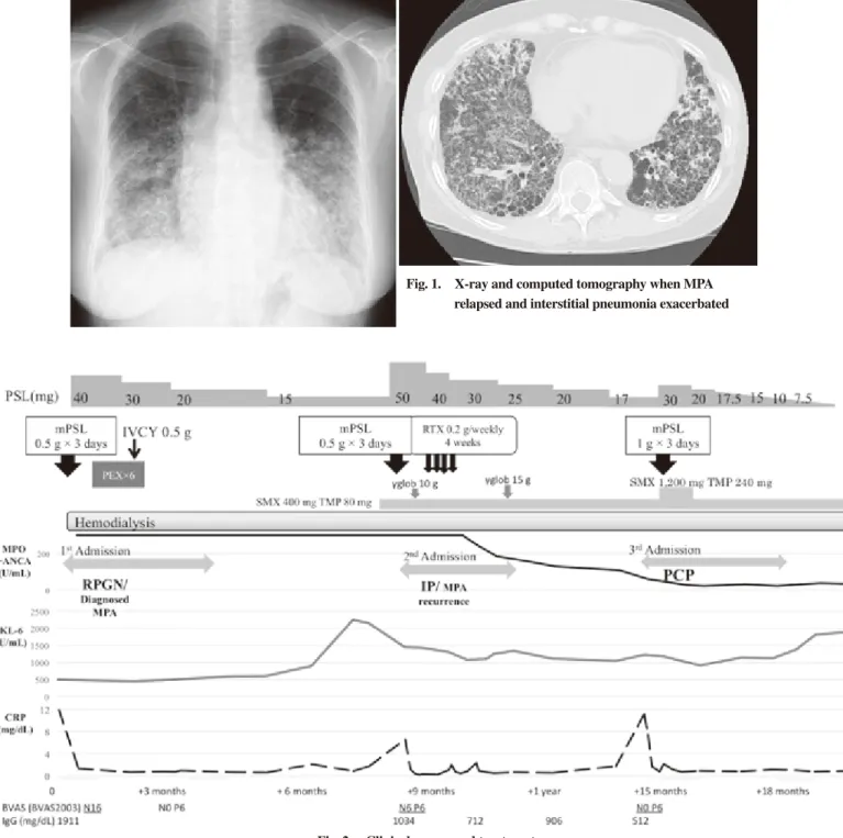 Fig. 2.   Clinical course and treatment