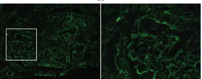 Fig. 2. Histopathological features of a renal biopsy specimen examined using light microscopy