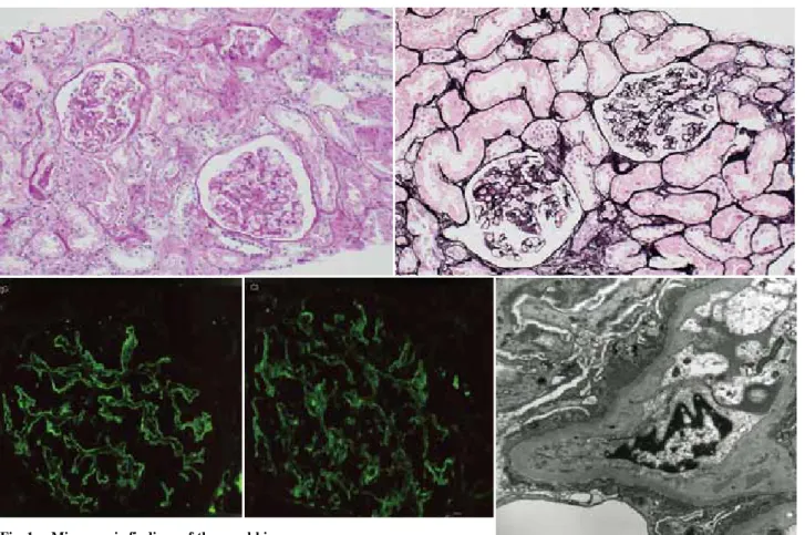 Fig.  1. Microscopic findings of the renal biopsy