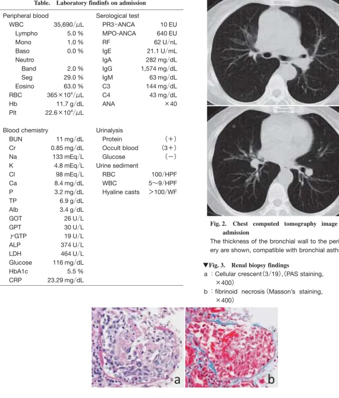 Fig.  2. Chest computed tomography image on  admission