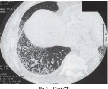 Fig.  2. Renal biopsy specimens