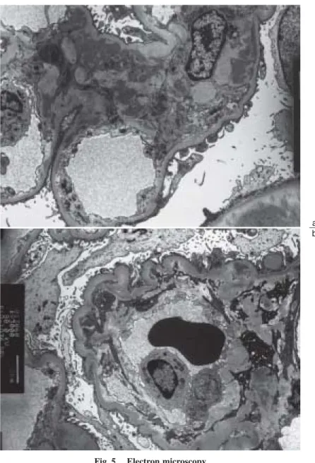 Fig.  5. Electron microscopy
