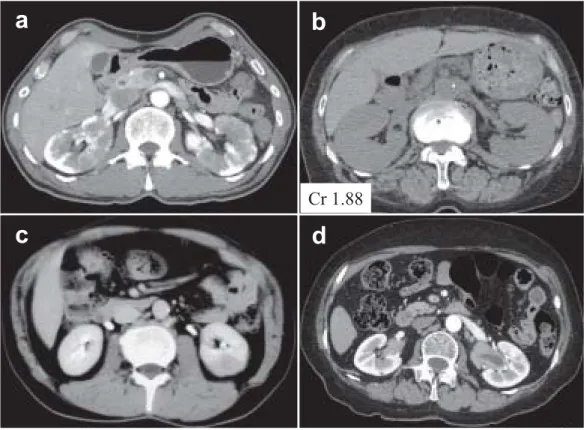 図  1 特徴的な腎の画像所見（CT）