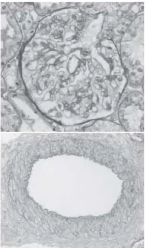 Fig.  1. Light microscopic findings of kidney  a ：There is no apparent proliferative or sclerotic 
