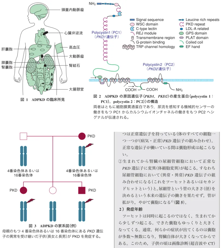 図  1 ADPKD の臨床所見 頭蓋内動脈瘤 心臓弁逆流  高血圧  大動脈瘤 腎結石  大腸憩室 肝囊胞 膵囊胞 腎囊胞  図  2 ADPKD の原因遺伝子（PKD1，PKD2）の産生蛋白（polycystin 1： PC1），polycystin 2：PC2））の構造 両者はともに細胞膜貫通蛋白であり，尿流を感知する機械的センサーの 働きをもつ PC1 からカルシウムイオンチャネルの働きをもつ PC2 へシ グナルが伝達される。 Signal sequence WSC domain C-type l