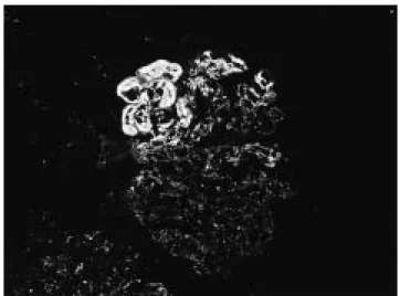 Fig.  4. Light microscopic findings （Periodic acid- acid-methenamine-silver stain） in case 2 （×400）