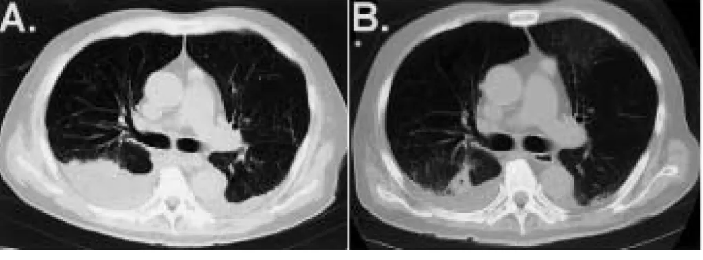 Fig.  2. Clinical course