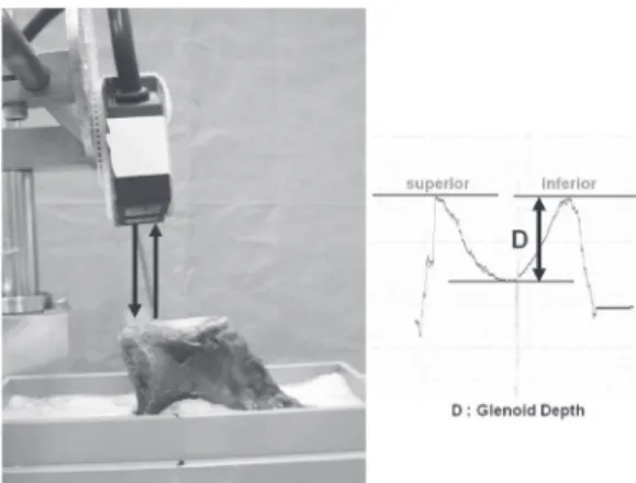 Fig. 2.  Measurement of the glenoid depth using a laser  displacement sensor