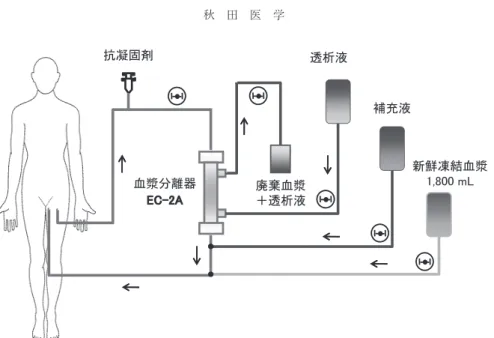 図 8. Plasma filtration with dialysis  （PDF）療法の施行条件