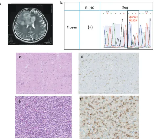 Table 2.  Primary antibodies for frozen and FFPE specimens employed in the study.