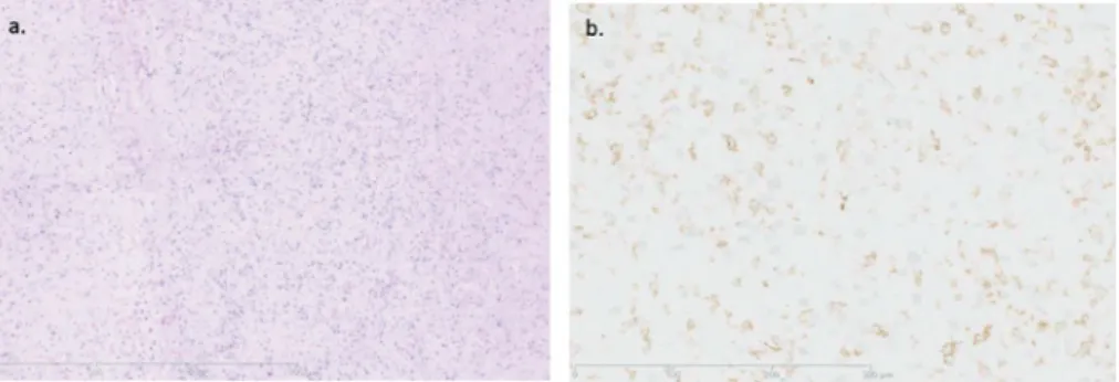 Fig. 2.   Histological findings in patient 4.
