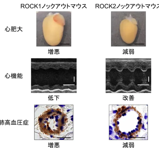 図 2. ROCK1 ノックアウトマウスと ROCK2 ノックアウトマウスの圧負荷応答 の違い 