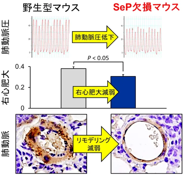 図 3. セレノプロテイン P 遺伝子欠損マウスは肺高血圧症が減弱  セレノプロテイン P 遺伝子を欠損させたマウスと通常のマウスに対して、肺高 血圧を発症させるモデルを作成して比較した結果、セレノプロテイン P 欠損マ ウスは肺血圧、右心室心筋の肥大（右心不全の徴候） 、肺動脈血管の狭窄（リモ デリング）の全てが減弱し、肺高血圧症にならないことを発見しました。