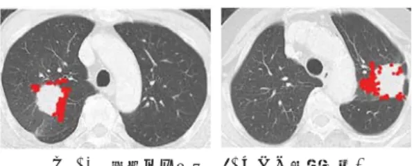 Fig. 13 The results of from (1) to (4) in recognition process.