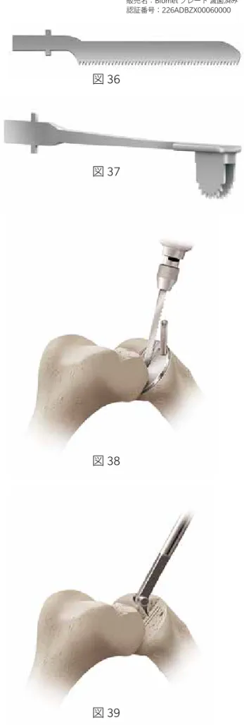 図 38 図 39脛骨プラトーへの最終処理選択したティビアルテンプレートを挿入し、脛骨後方の骨皮質にテンプレートの後部の辺縁が一致するよう設置します。リームバルフックを脛骨後方の皮質に掛け、位置決めをします。ブレードのオプション脛骨キール用に10mmの深さで溝を作成するには、レシプロソーブレード（図36）とキールカットソーブレード（図37）の2種類のブレードのオプションがあります（9頁 The OxfordPartial Knee Saw Blades参照）。レシプロブレードを用いる場合は、ティビアルテンプ