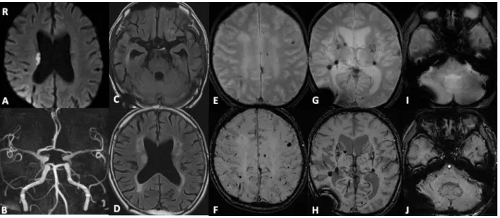 Fig. 1 MR imaging (Case 1).