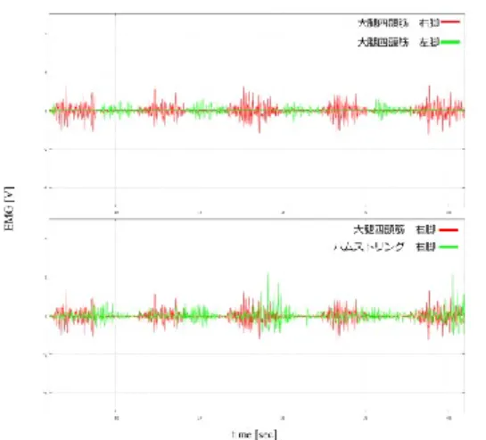 図  4  条件 1 のときの EMG  Figure 4  EMG under condition1. 