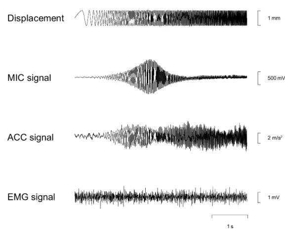図 2: Time series of displacement of the mechanical stimulator, microphone (MIC) signal, acceler- acceler-ation (ACC) signal, and electromyogram (EMG) signal of vastus medialis muscle during isometric knee extension at 40% of subjects’ maximal voluntary con