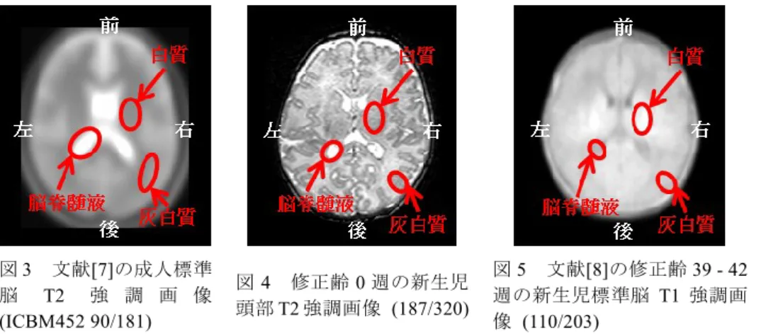 図 3  文献[7]の成人標準 脳 T2 強 調 画 像  (ICBM452 90/181)  図 4  修正齢 0 週の新生児頭部T2 強調画像  (187/320)  図 5  文献[8]の修正齢 39 - 42週の新生児標準脳T1強調画像  (110/203) 
