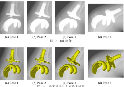 図  10   提案手法による推定結果 nn Re-sampling Likelihood function erase 図   8   リサンプリングの例 表   1   位置関係の知識a b c  d  e  f Translation[mm] x -5.0-4.0-3.03.0 4.0  5.0 y 0.0 5.0 10.015.020.0 25.0 z -50.0 -45.0 -40.0 -30.0-25.0 -20.0 Knee joint angle [deg]f/e-25.0 -20.0 -1