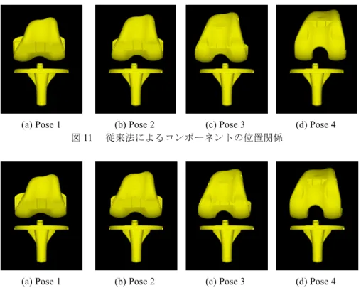 図  11   従来法によるコンポーネントの位置関係