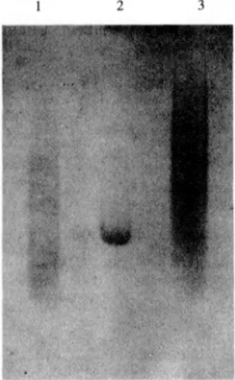 Fig. 16 Comparison of molecular weight distribution of HGluAsp(Glu 17 Asp) 4  -GluGluOH with two commercial PLGAs on a 12% polyacrylamide gel.