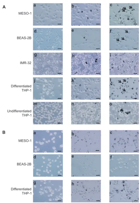 Figure  1 Light  microscopy  image  of  cells  exposed  to  VGCF.  Images  from  the  bright-field  mode,  in  which  VGCF  or  SB  can  be  easily  seen,  are  merged  with  images  from the phase-contrast mode, in which the cells can be clearly seen