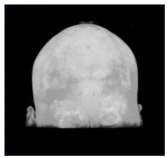 図 1 スライス画像例 Fig. 1 A example slice of MRI