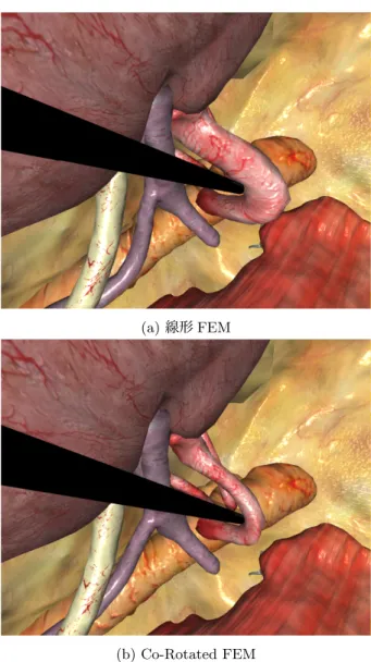 図 3 手術シミュレータ上での腎動脈変形結果: 腎動脈の直径は，術具とほぼ等しく 5mm 程度である．(a) は線形 FEM による変形結果で，血管体積が膨張している．(b) は Co-Rotated FEM による変形結果で現実に近い．