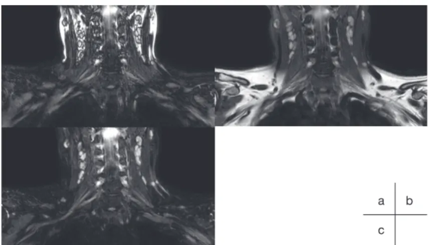 Fig. 9 Comparison of the CV for 3D TSE images using different fat suppression techniques (healthy volunteer images) 