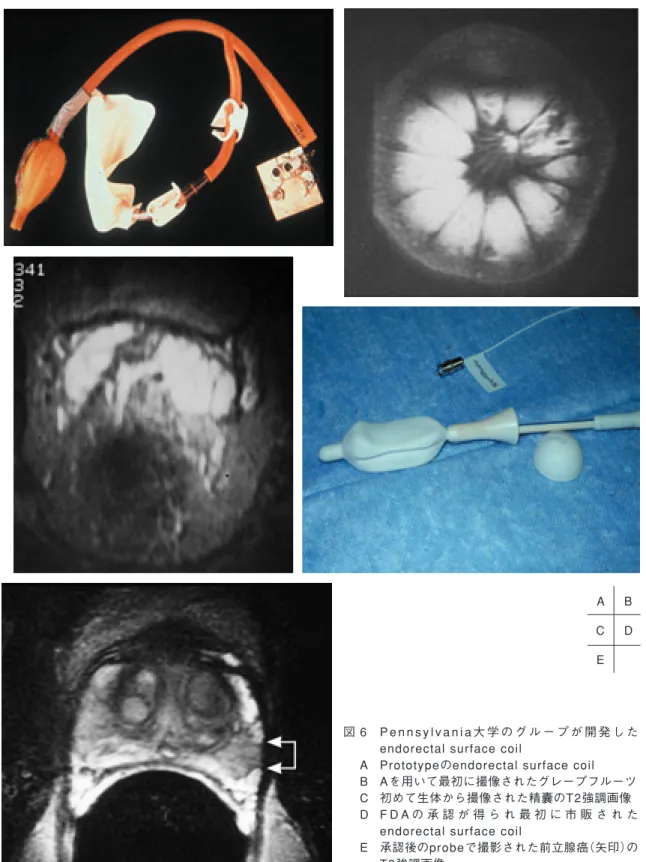 図 6 P e n n s y l v a n i a 大 学 の グ ル ー プ が 開 発 し た endorectal surface coil