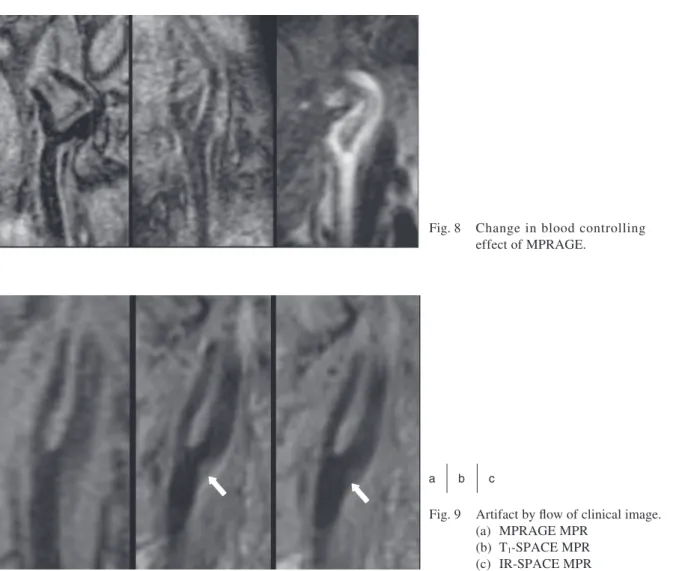 Fig. 8  Change in blood controlling  effect of MPRAGE.