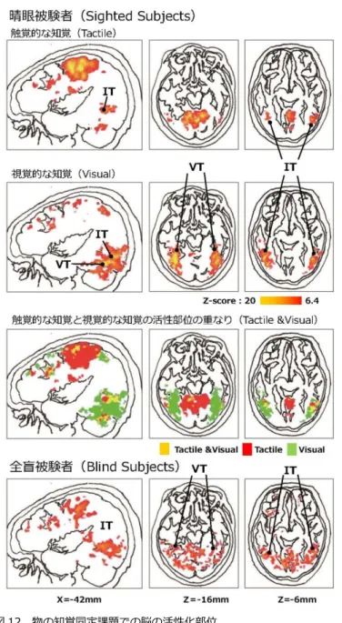 図 12  物の知覚同定課題での脳の活性化部位       