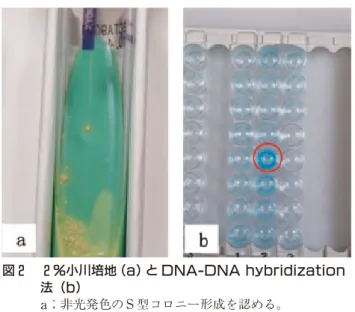 表 2 本菌との遺伝子の相同性