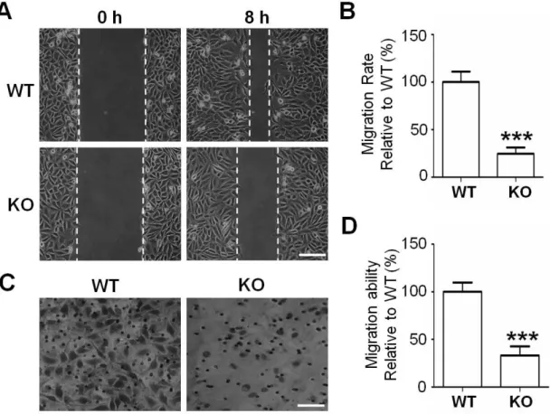 Figure 5. Comparison of cell migration between the WT and KO cells. 