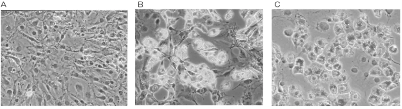 図 1：TBR311細胞の脂肪細胞分化 A：維持培養で飽和状態となった TBR311細胞。B：分化誘導 6 日目には細胞内に脂肪滴が観察できる。C：分化誘導 6 日目に脂肪滴をオイルレッド染色した。蓄積に対する影響を調べることとした。 通常臨床的に用いられているアミノ酸の投与量は、1 日あたり1 g程度なので、体重が60 kgの場合、アミノ酸の分子量にもよるが、そのままの量が血流に入ったと仮定すれば数mMになることが予想されることから、今回の実験では、培地に含まれるアミノ酸とは別に添加するアミノ酸濃度を2 