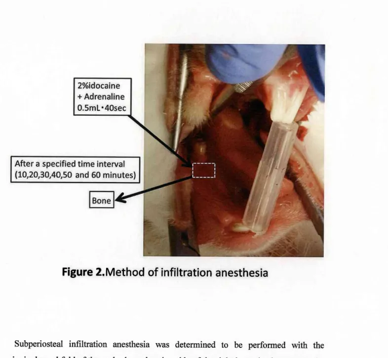 Figure  2.Method  of infiltration  anesthesia