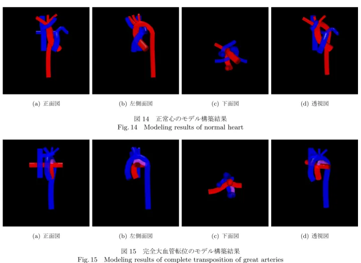 図 14 正常心のモデル構築結果 Fig. 14 Modeling results of normal heart